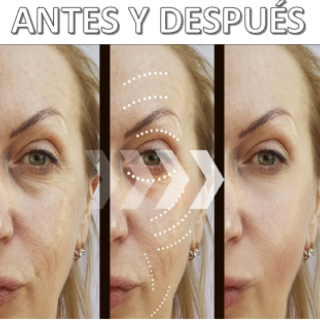 Masajeador Facial ionico ANTIARRUGAS DERMALIGHT™